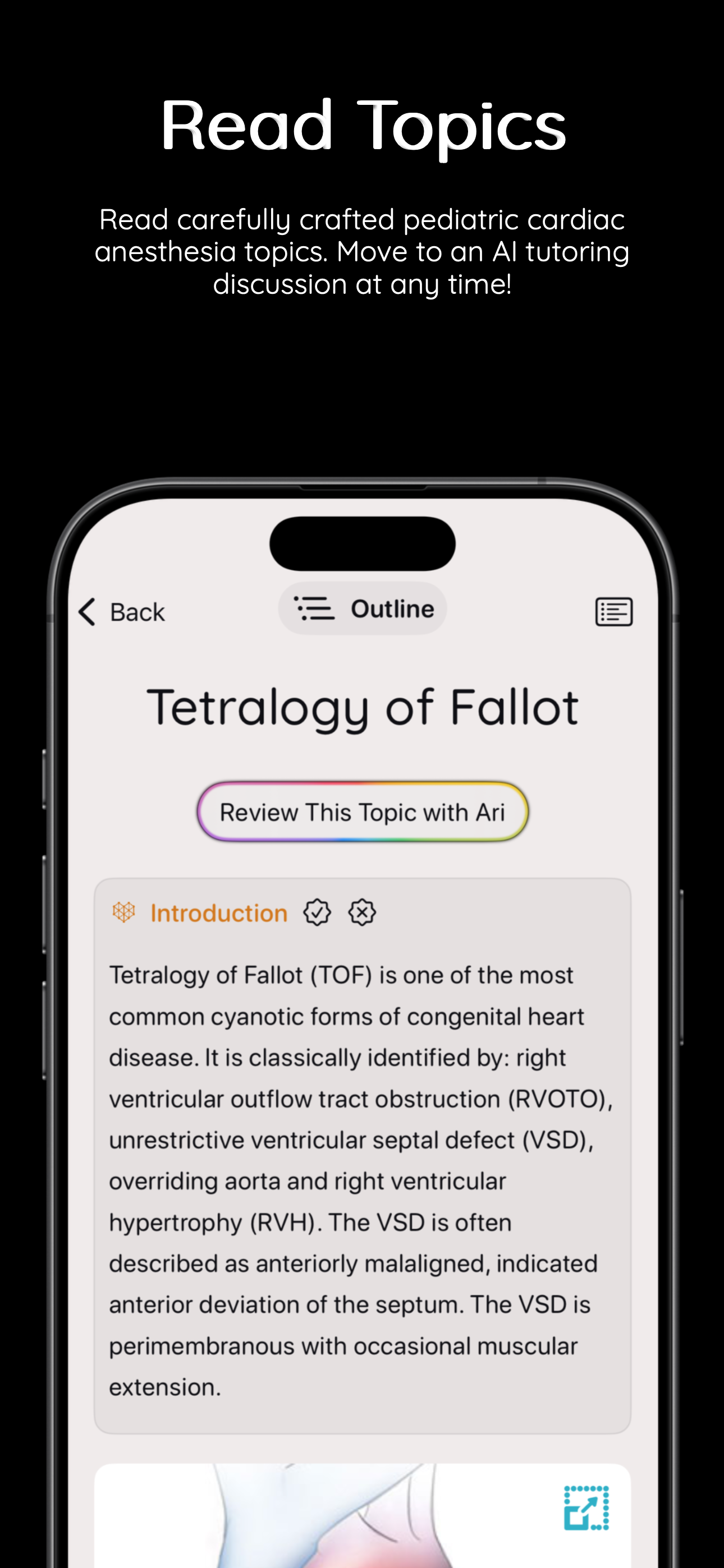 Lusitropy Read Topics Screenshot